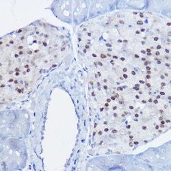 Invitrogen Nkx6.1 Polyclonal Antibody 100 &mu;L; Unconjugated:Antibodies,