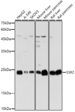 Invitrogen SSR2 Polyclonal Antibody 100 &mu;L | Buy Online | Invitrogen&trade; | Fisher Scientific
