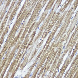 Invitrogen PYCARD Polyclonal Antibody 100 &mu;L | Buy Online | Invitrogen&trade; | Fisher Scientific