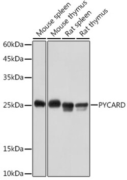 Invitrogen PYCARD Polyclonal Antibody 100 &mu;L | Buy Online | Invitrogen&trade; | Fisher Scientific