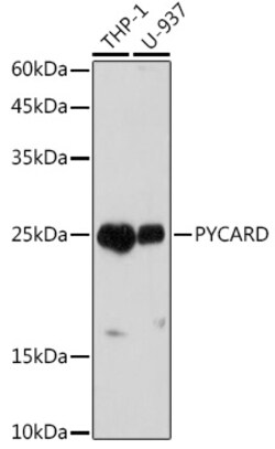 Invitrogen PYCARD Polyclonal Antibody 100 &mu;L | Buy Online | Invitrogen&trade; | Fisher Scientific
