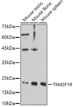 Invitrogen TM4SF19 Polyclonal Antibody 100 &mu;L | Buy Online | Invitrogen&trade; | Fisher Scientific