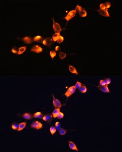 Invitrogen PSA Polyclonal Antibody 100 &mu;L; Unconjugated:Antibodies,