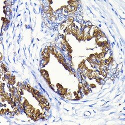 Invitrogen PSA Polyclonal Antibody 100 &mu;L; Unconjugated:Antibodies,