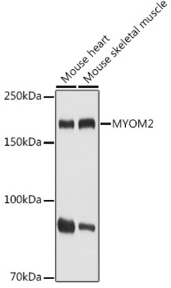 Invitrogen MYOM2 Polyclonal Antibody 100 &mu;L; Unconjugated:Antibodies,