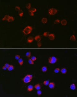 Invitrogen HTR2A Polyclonal Antibody 100 &mu;L; Unconjugated:Antibodies,