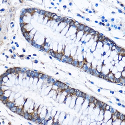 Invitrogen CAPZA2 Polyclonal Antibody 100 μL; Unconjugated:Antibodies,
