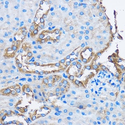 Invitrogen CAPZA2 Polyclonal Antibody 100 μL; Unconjugated:Antibodies,