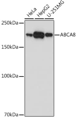 Invitrogen ABCA8 Polyclonal Antibody 100 &mu;L | Buy Online | Invitrogen&trade; | Fisher Scientific