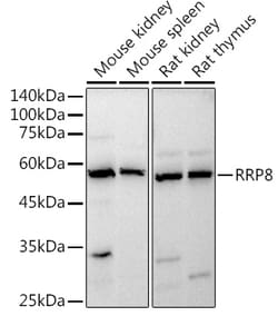 Invitrogen Cerebral Protein 1 Polyclonal Antibody 100 μL; Unconjugated:Antibodies,