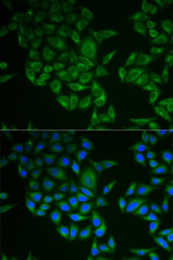 Invitrogen CD3 zeta (CD247) Polyclonal Antibody 100 &mu;L; Unconjugated:Antibodies,
