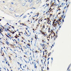 Invitrogen CD3 zeta (CD247) Polyclonal Antibody 100 &mu;L; Unconjugated:Antibodies,