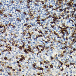 Invitrogen CD3 zeta (CD247) Polyclonal Antibody 100 &mu;L; Unconjugated:Antibodies,