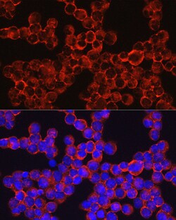 Invitrogen CD33 Polyclonal Antibody 100 &mu;L; Unconjugated:Antibodies,