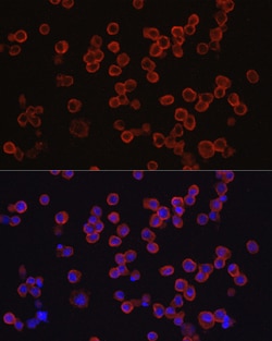 Invitrogen CD33 Polyclonal Antibody 100 &mu;L; Unconjugated:Antibodies,
