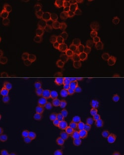 Invitrogen CD33 Polyclonal Antibody 100 &mu;L; Unconjugated:Antibodies,