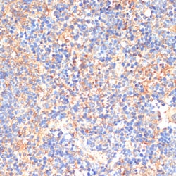 Invitrogen CD33 Polyclonal Antibody 100 &mu;L; Unconjugated:Antibodies,