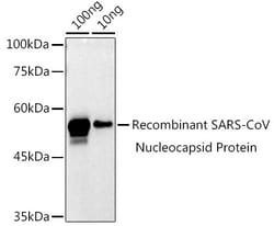 Invitrogen SARS-CoV-2 Nucleocapsid Polyclonal Antibody 100 &mu;L; Unconjugated:Antibodies,