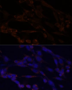 Invitrogen IKK alpha Polyclonal Antibody 100 &mu;L; Unconjugated:Antibodies,