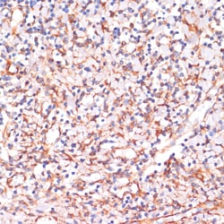 Invitrogen IKK alpha Polyclonal Antibody 100 &mu;L; Unconjugated:Antibodies,