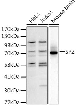Invitrogen SP2 Polyclonal Antibody 100 μL; Unconjugated:Antibodies,