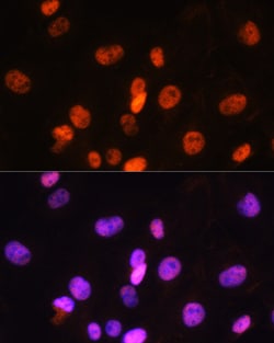 Invitrogen FANCD2 Polyclonal Antibody 100 &mu;L | Buy Online | Invitrogen&trade; | Fisher Scientific