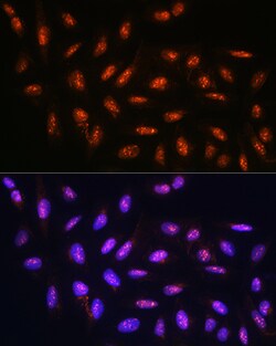 Invitrogen FANCD2 Polyclonal Antibody 100 &mu;L | Buy Online | Invitrogen&trade; | Fisher Scientific
