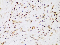 Invitrogen IKK beta Polyclonal Antibody 100 &mu;L; Unconjugated:Antibodies,