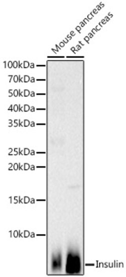 Invitrogen Insulin Polyclonal Antibody 100 &mu;L | Buy Online | Invitrogen&trade; | Fisher Scientific
