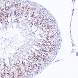 Invitrogen Integrin alpha V (CD51) Polyclonal Antibody 100 &mu;L; Unconjugated:Antibodies,