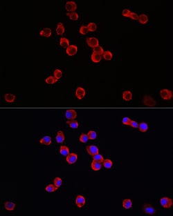 Invitrogen TrkB Polyclonal Antibody 100 μL; Unconjugated:Antibodies,