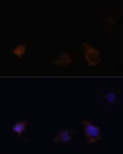 Invitrogen Zyxin Polyclonal Antibody 100 &mu;L; Unconjugated:Antibodies,