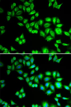 Invitrogen Cullin 1 Polyclonal Antibody 100 &mu;L; Unconjugated:Antibodies,