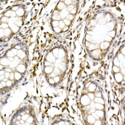 Invitrogen Cullin 1 Polyclonal Antibody 100 &mu;L; Unconjugated:Antibodies,