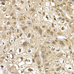 Invitrogen Cullin 1 Polyclonal Antibody 100 &mu;L; Unconjugated:Antibodies,