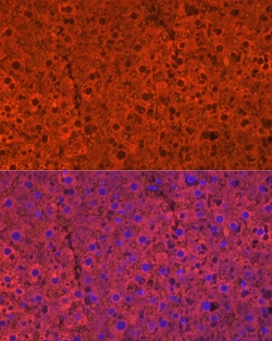 Invitrogen CYP2E1 Polyclonal Antibody 100 μL; Unconjugated:Antibodies,