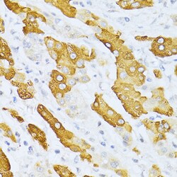 Invitrogen CYP2E1 Polyclonal Antibody 100 μL; Unconjugated:Antibodies,