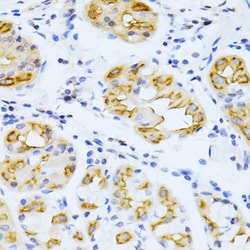 Invitrogen CYP2E1 Polyclonal Antibody 100 μL; Unconjugated:Antibodies,