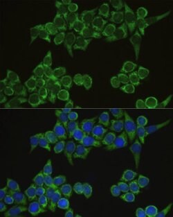 IRF3 Polyclonal Antibody, Invitrogen 100 &mu;L | Buy Online | Invitrogen | Fisher Scientific