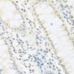 IRF3 Polyclonal Antibody, Invitrogen 100 &mu;L | Buy Online | Invitrogen | Fisher Scientific