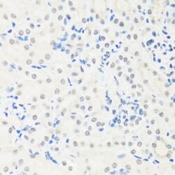 IRF3 Polyclonal Antibody, Invitrogen 100 &mu;L | Buy Online | Invitrogen | Fisher Scientific
