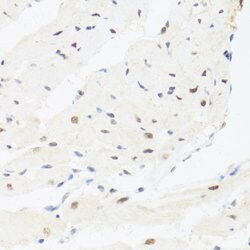 IRF3 Polyclonal Antibody, Invitrogen 100 &mu;L | Buy Online | Invitrogen | Fisher Scientific