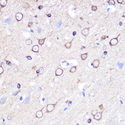 Invitrogen Stathmin 1 Polyclonal Antibody 100 &mu;L; Unconjugated:Antibodies,