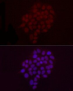 Invitrogen H3K9me2 Polyclonal Antibody 100 &mu;L; Unconjugated:Antibodies,
