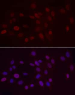 Invitrogen H3K9me2 Polyclonal Antibody 100 &mu;L; Unconjugated:Antibodies,