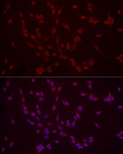 Invitrogen H3K9me2 Polyclonal Antibody 100 &mu;L; Unconjugated:Antibodies,