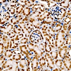 Invitrogen H3K9me2 Polyclonal Antibody 100 &mu;L; Unconjugated:Antibodies,