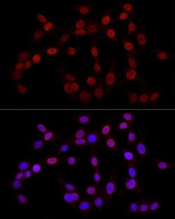 Invitrogen H3K27me3 Polyclonal Antibody 100 &mu;L; Unconjugated:Antibodies,
