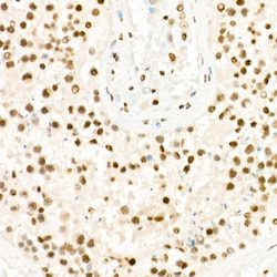 Invitrogen H3K27me3 Polyclonal Antibody 100 &mu;L; Unconjugated:Antibodies,