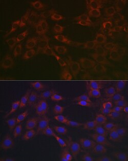 Invitrogen SERPINH1 Polyclonal Antibody 100 &mu;L; Unconjugated:Antibodies,